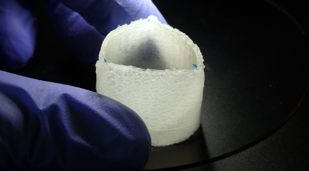 Close-up for an artificial heart valve designed to grow with a patient, highlighting innovation in bioengineered medical implants for cardiovascular health.