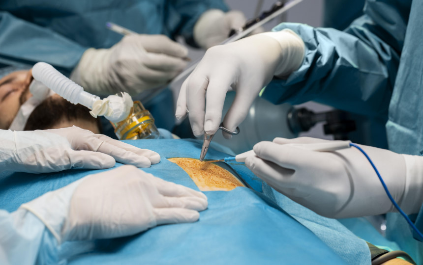 Surgeons performing minimally invasive cardiac surgery (MICS) with precision guided by Dr. Jaibhagwan Dhull, a renowed cardiothoracic and vascular surgeon.