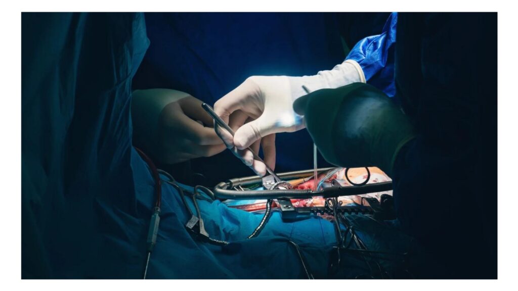 Cardiac surgeons performing an open-heart surgery with precision instruments, showcasing expertise in advanced heart care by Dr. Jai Bhagwan Dhull.