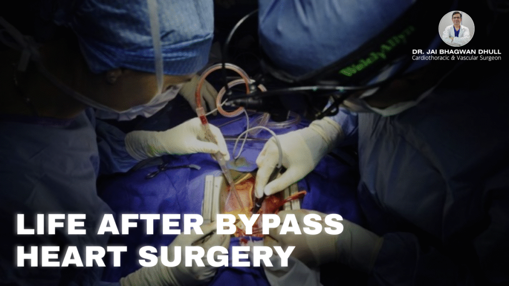 Doctors performing open-heart bypass surgery in an operating room – guided by Dr. Jai Bhagwan Dhull, Cardiothoracic & Vascular Surgeon.