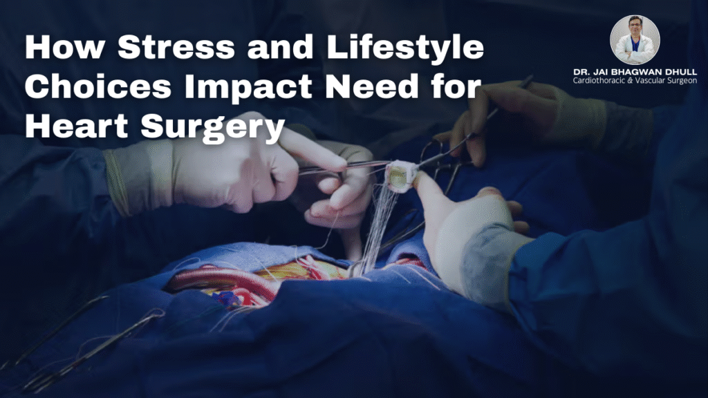 Surgeons performing heart surgery with text overlay “How Stress and Lifestyle Choices Impact Need for Heart Surgery” featuring Dr. Jai Bhagwan Dhull, Cardiothoracic & Vascular Surgeon.