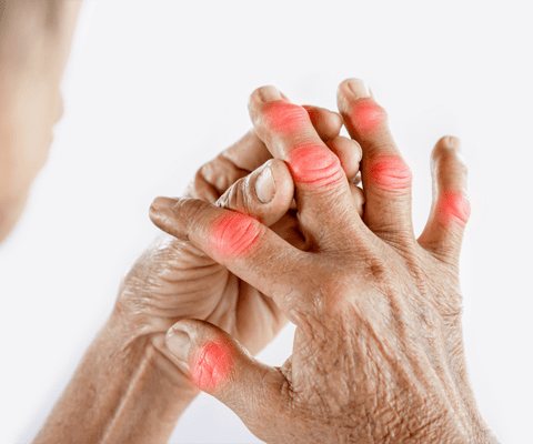 Close-up of elderly hands showing joint pain and inflammation in fingers, symbolizing arthritis and rheumatology concerns, with medical expertise guidance from Dr. Jai Bhagwan Dhull.
