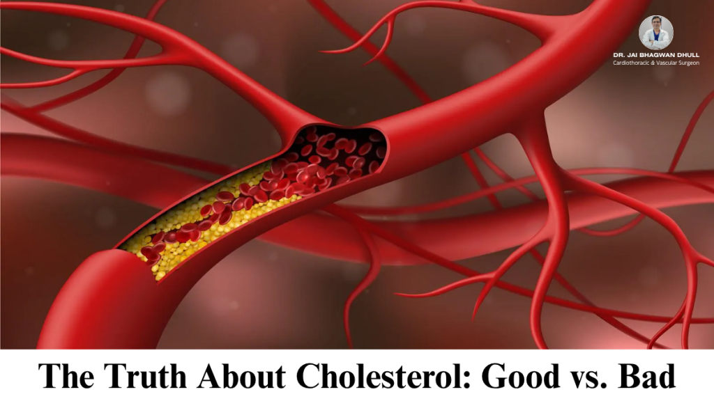 Cross-sectional view of a blood vessel showing cholesterol buildup and blood cells, educational graphic by Dr. Jai Bhagwan Dhull.